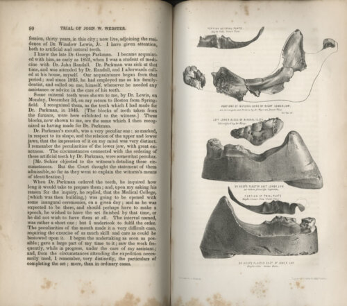 The interior of an old book. The left page has text and the right side has images of dentures and bone fragments used as trial evidence.